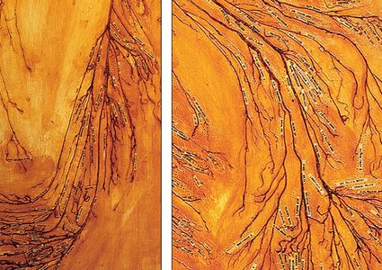 عملية تشريح عالمية استمرت 1500 ساعة