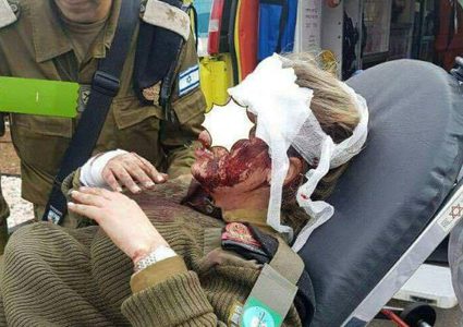 الإحتلال يزعم اصابة مجندة من قواته في القدس