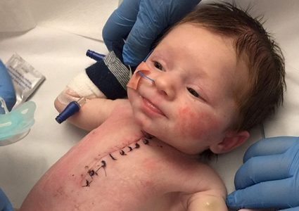 هذه أندر وأخطر جراحة في التاريخ