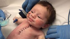 هذه أندر وأخطر جراحة في التاريخ