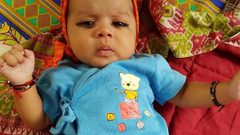 اقتلاع 7 أسنان من فم طفل عمره شهر واحد!