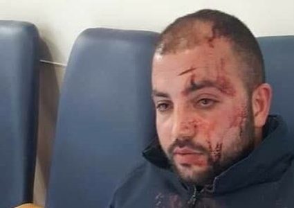 مستوطنون يعتدون على مواطن شرق الخليل