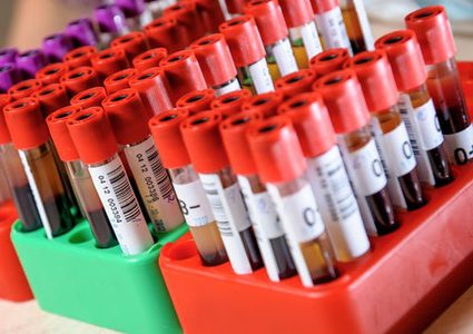 اختبار دم للكشف عن ارتجاج المخ بدلاً من الأشعة (فيديو)