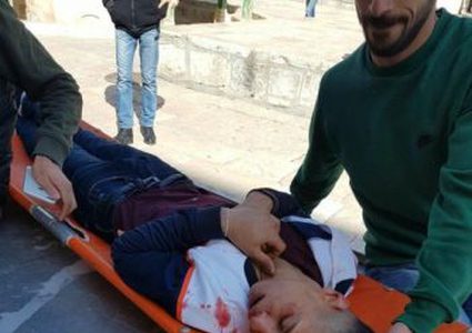 نقل شاب تعرض لاعتداء المستوطنين قبل أيام  إلى المستشفى