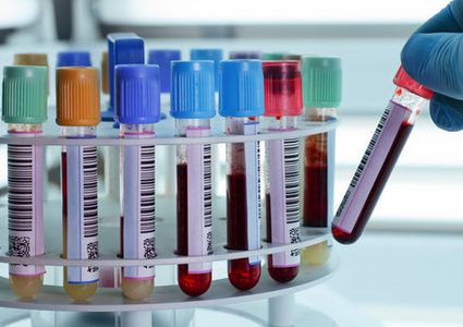 خبراء يطورون اختبار دم من المحتمل أن يكشف عن التوحد