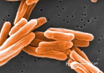 نجاح تجارب أولية للقاح جديد للسل