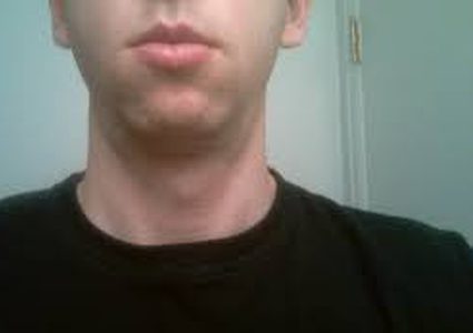 لماذا يعاني البعض من تضخم حجم الغدد