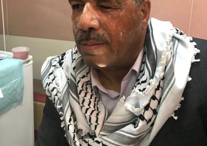 إصابة الوزير وليد عساف بقمع الاحتلال لمسيرة غرب رام الله(صور)