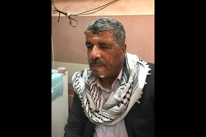 إصابة الوزير وليد عساف بقمع الاحتلال لمسيرة غرب رام الله(صور)