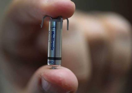 جسم الإنسان وحياته.. "ضحية جديدة" لقراصنة الإنترنت