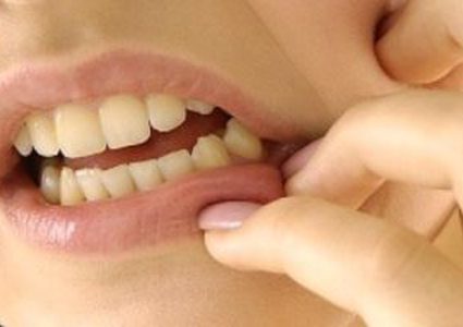 علاج ألم الأسنان بالطب البديل