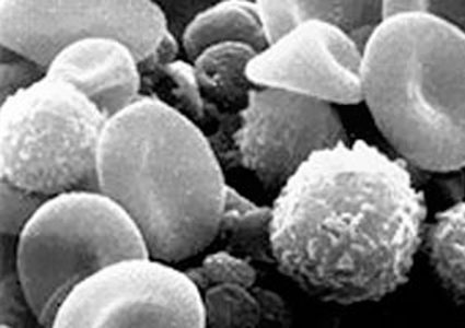 أسباب نقص كرات الدم البيضاء وأطعمة تساعد فى العلاج