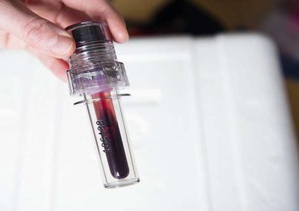 علماء يولودون الكهرباء من دم الإنسان!