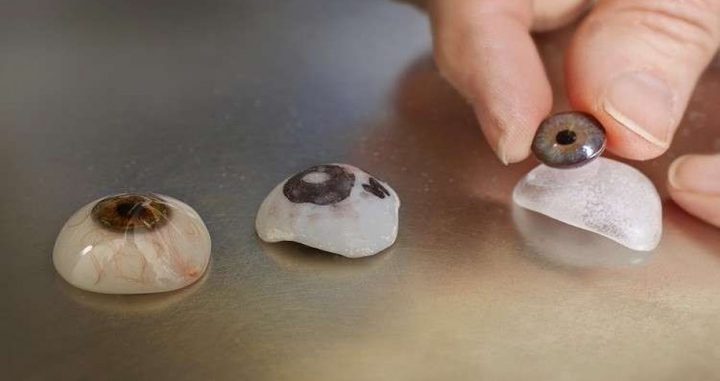 علماء يخترعون عين اصطناعية بتحكم إلكتروني