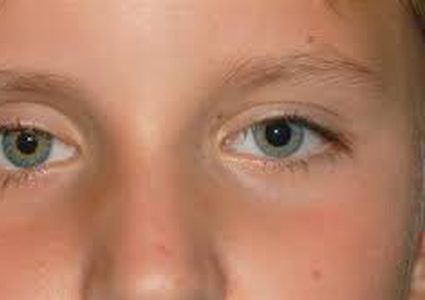 عين اصطناعية بتحكم إلكتروني