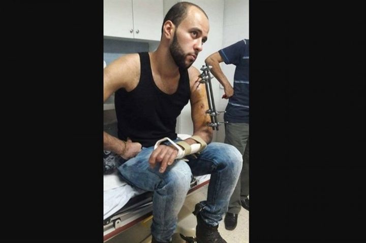 انهال عليه نحو عشرة جنود بالضرب..اعتداء على مصاب خلال اعتقاله