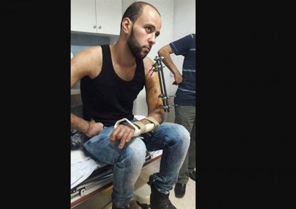 انهال عليه نحو عشرة جنود بالضرب..اعتداء على مصاب خلال اعتقاله