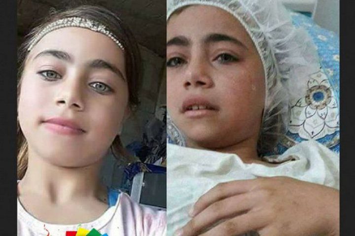 الاحتلال يسمح لوالدة الطفلة انعام بمرافقتها
