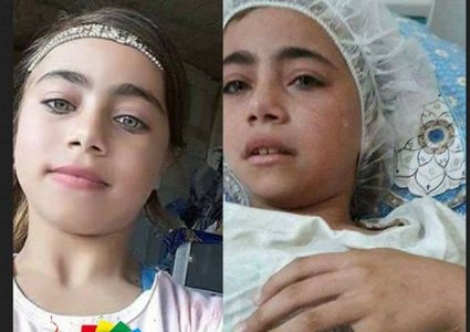 الاحتلال يسمح لوالدة الطفلة انعام بمرافقتها