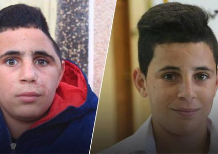 تقرير إسرائيلي يكذب ادعاءات قوات الاحتلال بعدم مسؤوليته عن إصابة الطفل التميمي