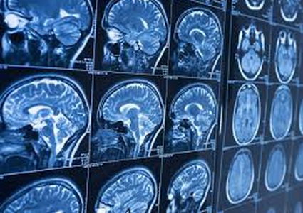 تلف الدماغ أحد أهم أسباب "الجرائم العنيفة"