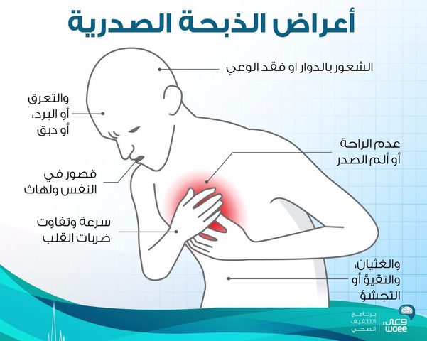 أعراض الذبحة الصدرية