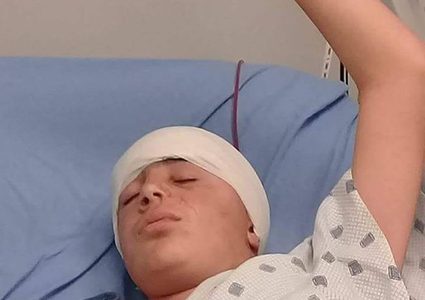 نجاح عملية ترميم جمجمة الطفل محمد التميمي