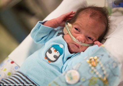 خرج إلى الحياة بعدما بقي 55 يوماً في رحم أمه الميتة!