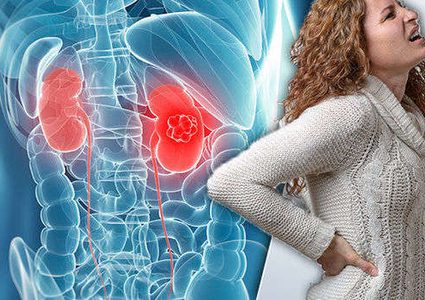 ألم قد يرتبط بسرطان الكبد