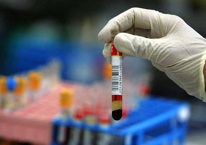 علاج يبشر بأمل دائم للنساء بعد الأربعين!