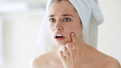 أسهل طريقة للتخلّص من الرؤوس السوداء!