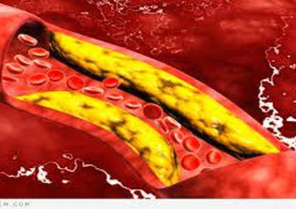 هل يقي الكوليسترول من الخرف!