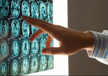 "معيار عرقي" يربك تشخيص السرطان