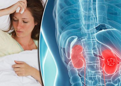 أمراض الكلى لدى النساء كيف تتجنبينها؟
