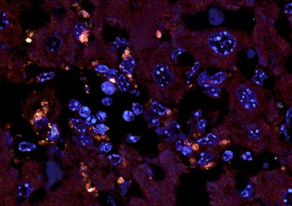 البكتيريا المعوية يمكن أن تسبب أمرض نقص المناعة الذاتية!