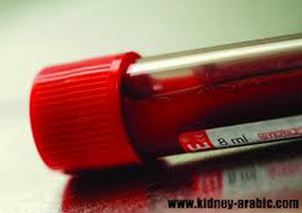 دراسة حديثة :أضرار السمنة تساوي أضرار التدخين