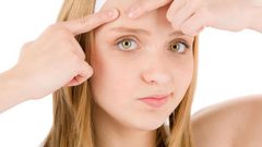 طريقة التخلص من الرؤوس السوداء نهائياً