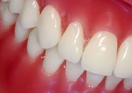 مؤشرات صامتة لأمراض اللثة لا يجب تجاهلها!