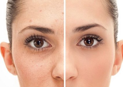 وصايا تجميليّة مضادة لشيخوخة البشرة