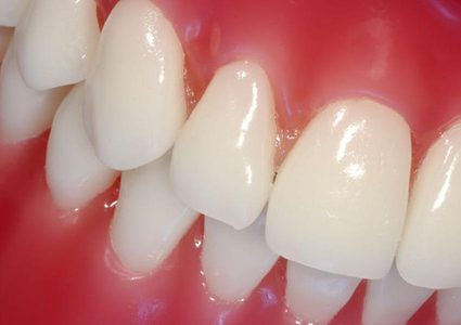 10 مؤشرات صامتة لأمراض اللثة.. فلا تتجاهلها!