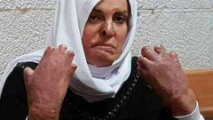 نقل الأسيرة جعابيص لمستشفى "هداسا"