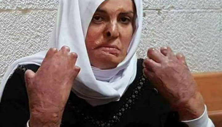 نقل الأسيرة جعابيص لمستشفى "هداسا"