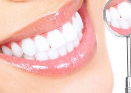 كل ما تريد معرفته عن تسوس الأسنان