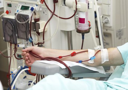 زراعة عروق جديدة لمساعدة الأشخاص الذين يعانون من غسيل الكلى