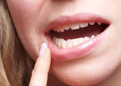 خلايا اللثة للمساعدة في التئام جروح السكري