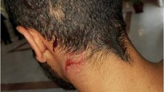 إصابة سائق مقدسي إثر اعتداء مستوطنين عليه