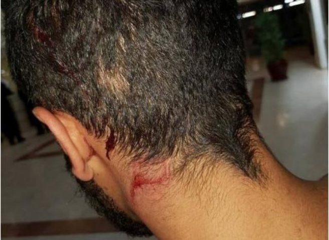 إصابة سائق مقدسي إثر اعتداء مستوطنين عليه