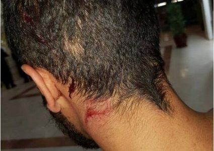 إصابة سائق مقدسي إثر اعتداء مستوطنين عليه