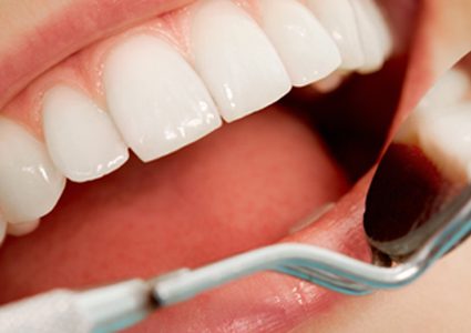 اكتشف علاقة العناية بالأسنان وإحتمالية الإصابة بالسكري