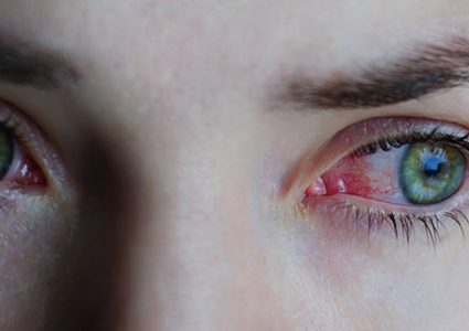 ما هي اسباب احمرار العين ؟